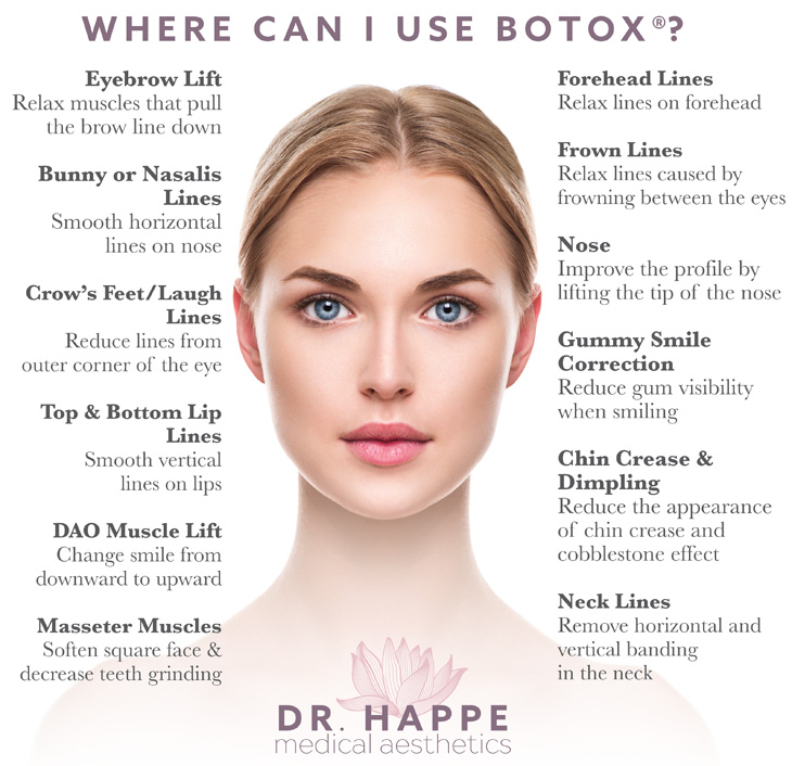 Allergan Botox 