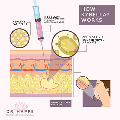 The active ingredient in BELLA® at Newton's Dr. Happe Medical Aesthetics is a form of naturally occurring deoxyvholic acid, which breaks down fat cells.