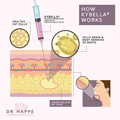 The active ingredient in BELLA® at Newton's Dr. Happe Medical Aesthetics is a form of naturally occurring deoxyvholic acid, which breaks down fat cells. The active ingredient in BELLA® at Newton's Dr. Happe Medical Aesthetics is a form of naturally occurring deoxyvholic acid, which breaks down fat cells.
